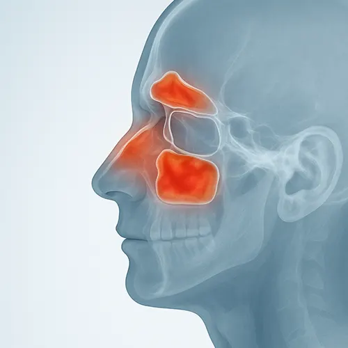 vista-anatomica-de-senos-paranasales-obstruccion-y-cirugia-endoscopica